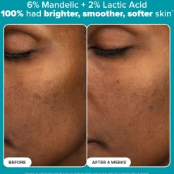 The Resurface & Hydrate Set