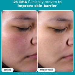 The Resurface & Hydrate Set