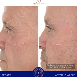 The Retinol Serum 30ML