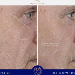 The Serum 50ML