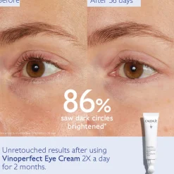 Vinoperfect Brightening Edit