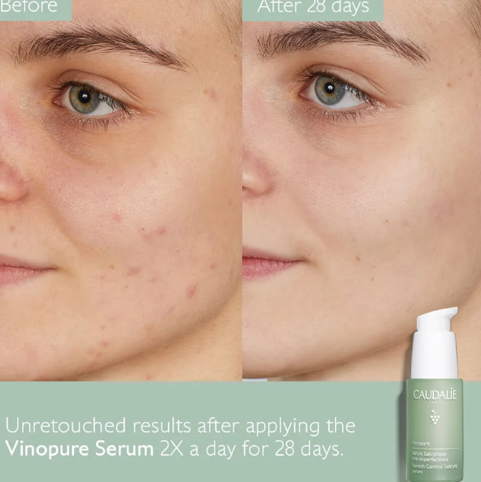Vinopure Blemish Serum 30ML