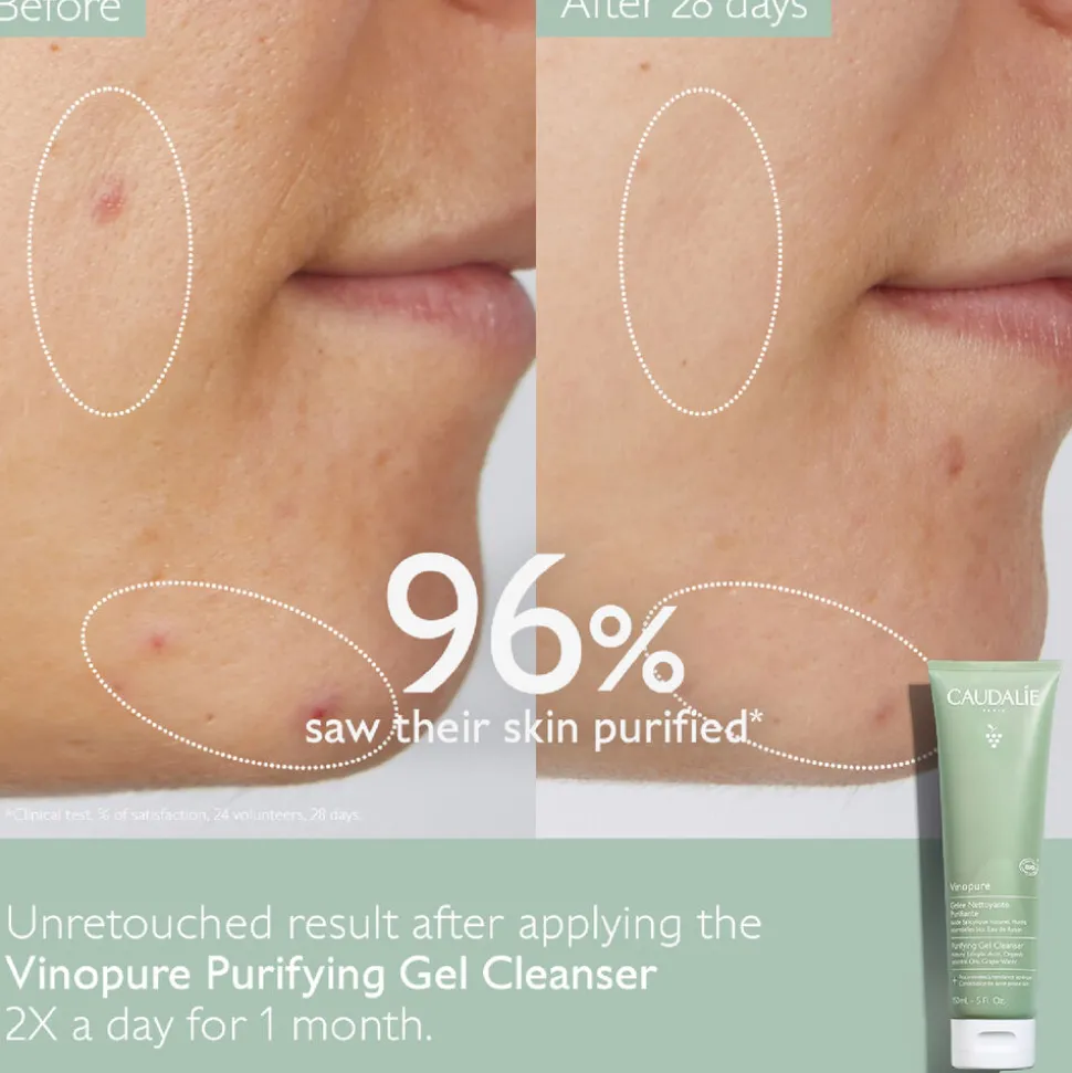 Vinopure Gel Cleanser 150ML