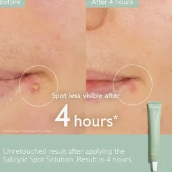 Vinopure Salicylic Spot Stop 15ML