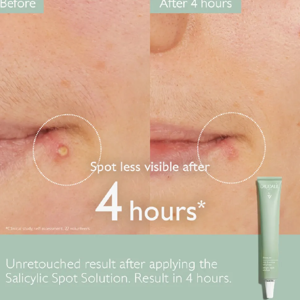 Vinopure Salicylic Spot Stop 15ML