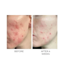 Violet Water Clearing Cleanser Blemish Control Facial Cleansing Gel 100ML