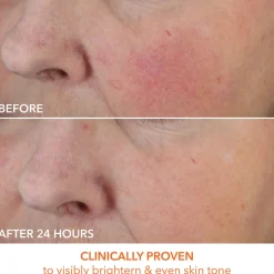 Vitamin C + Lactic Dewy Deep Cream 60ML