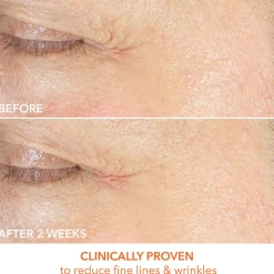 Vitamin C + Lactic Firm & Bright Eye Treatment 15ML