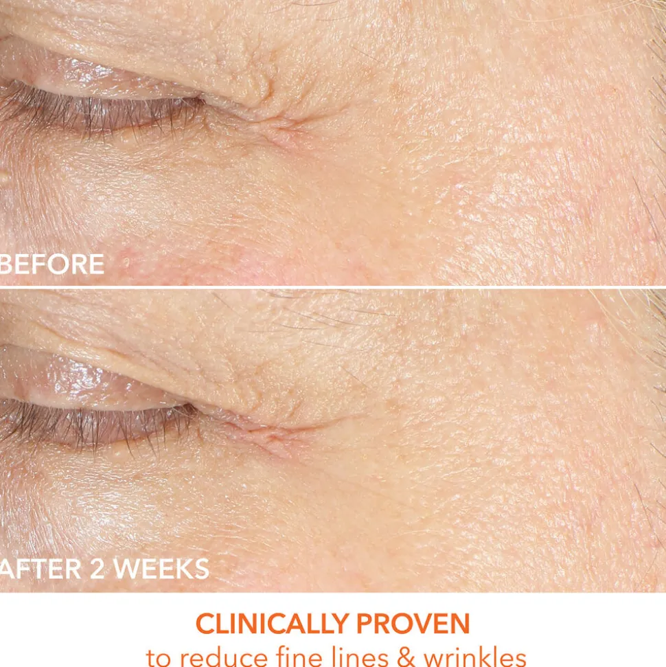 Vitamin C + Lactic Firm & Bright Eye Treatment 15ML