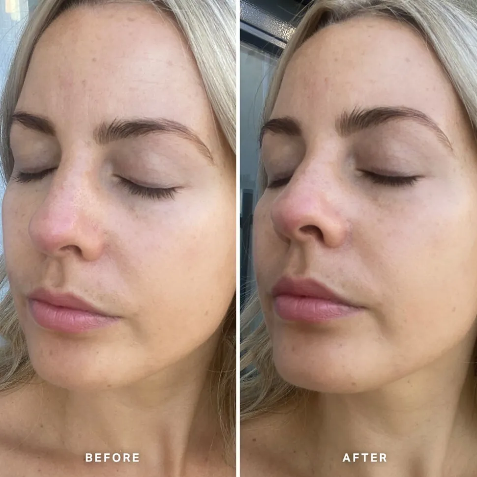 Vitamin E Serum 25ML